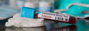 10 стран по числу зараженных коронавирусом и умерших от него